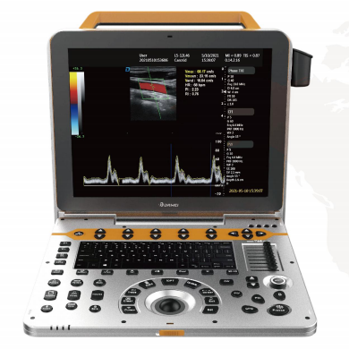 大为全数字彩色多普勒超声诊断仪DW-PF542