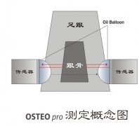 超声波骨密度仪UBD2002A